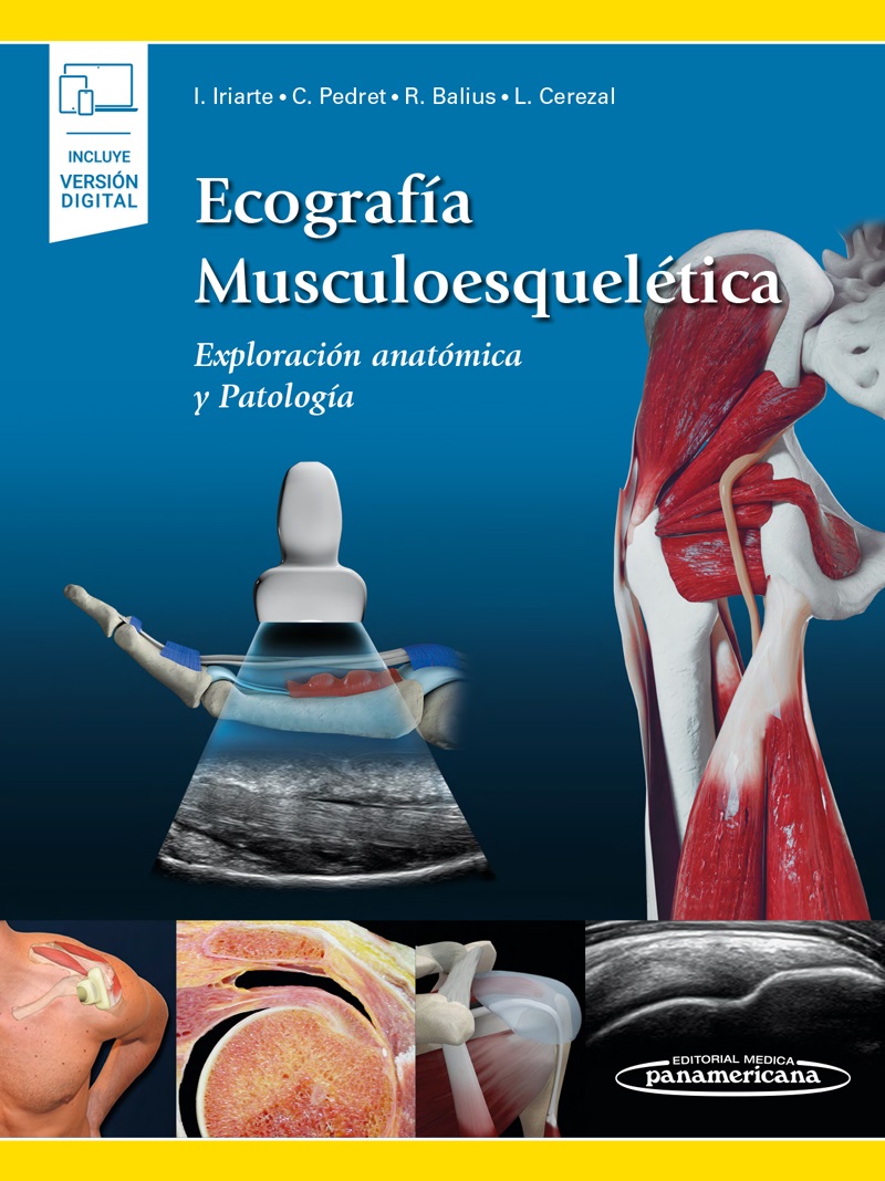 Ecografía Musculoesquelética Exploración De La Anatomía Y La Patología Incluye Ebook