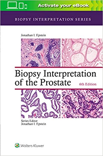 Biopsy Interpretation Of The Prostate 6Ed