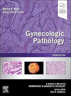 Gynecologic Pathology 2Ed (Enhanced Digital Version Included)