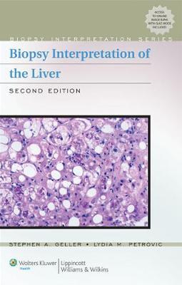 Biopsy Interpretation Of The Liver 2Ed