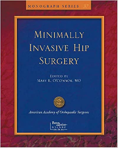 Limited Incisions For Total Hip Arthroplasty (Monograph Series)