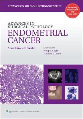Advances In Surgical Pathology: Endometrial Carcinoma