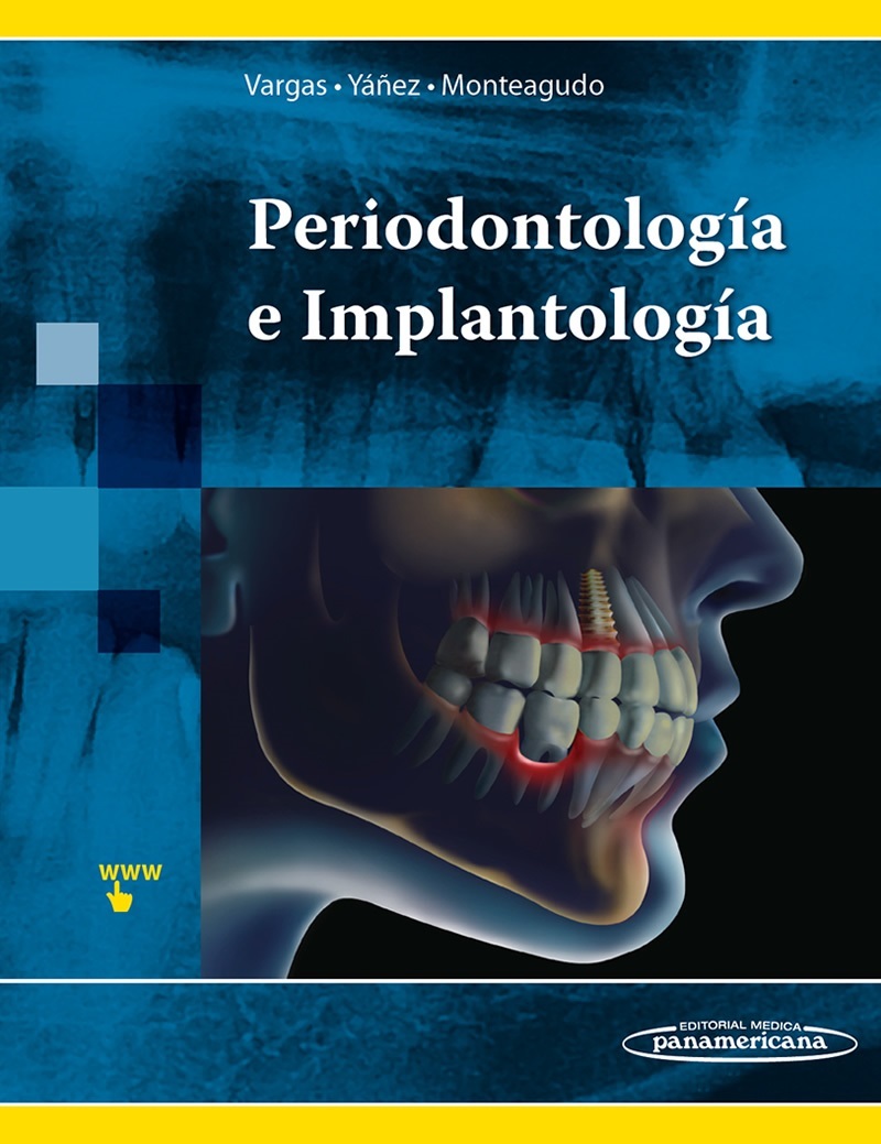 Periodontología E Implantología
