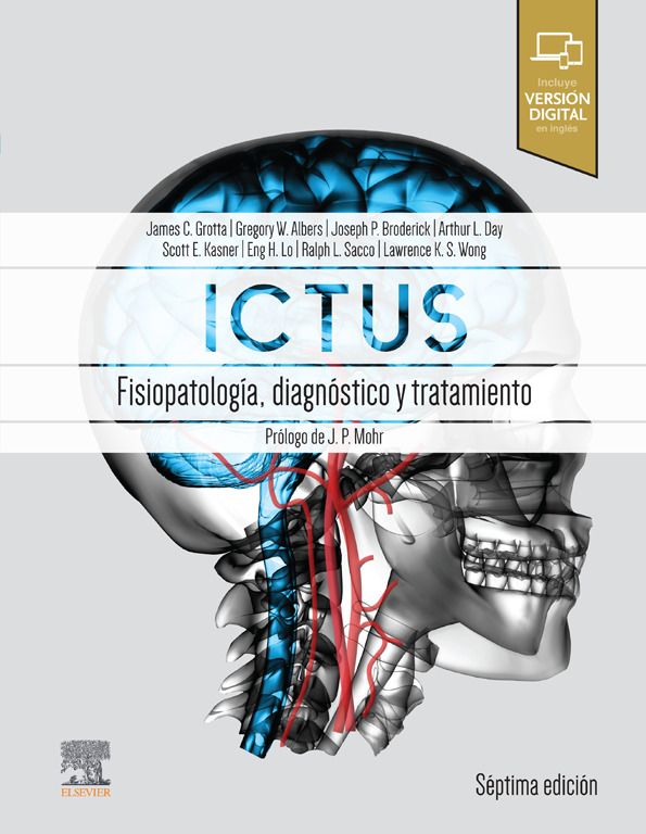 Ictus. Fisiopatología, Diagnóstico y Tratamiento