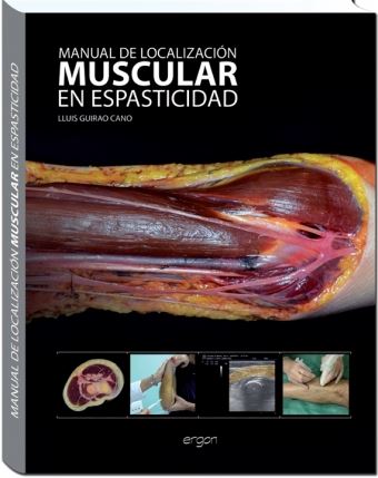 Mnl De Localizacion Muscular En Espasticidad