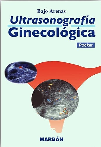 Ultrasonografía Ginecológica