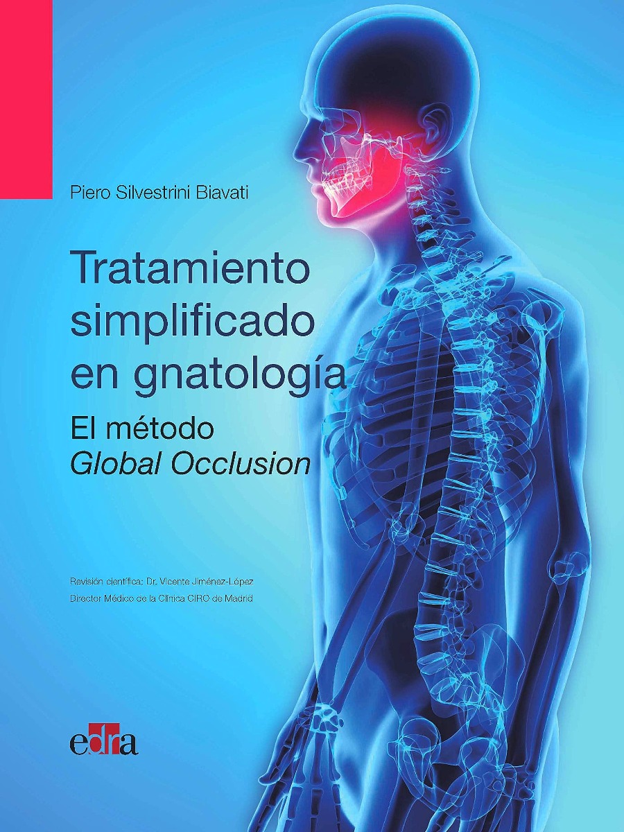 Oclusión Global Tratamiento Simplificado En Gnatología