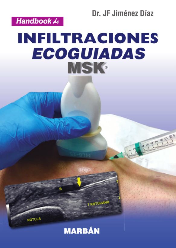 Handbook de Infiltraciones Ecoguiadas MSK