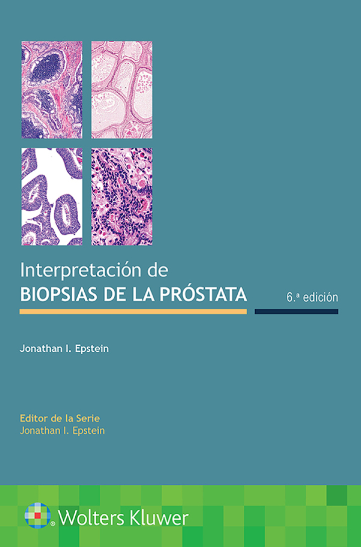 Interpretación De Biopsias De La Próstata.