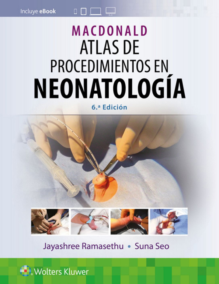 Macdonald Atlas De Procedimientos En Neonatología.