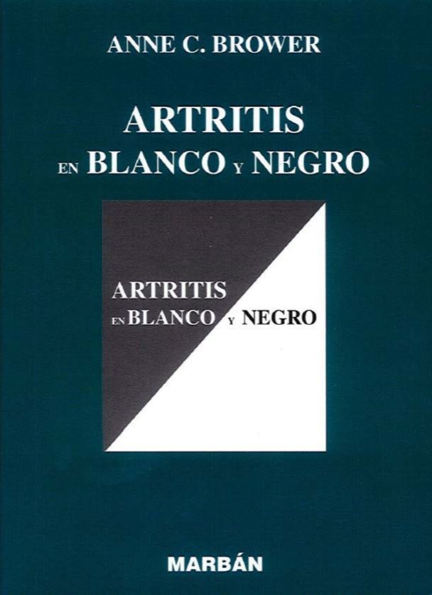 Artritis en Blanco y Negro