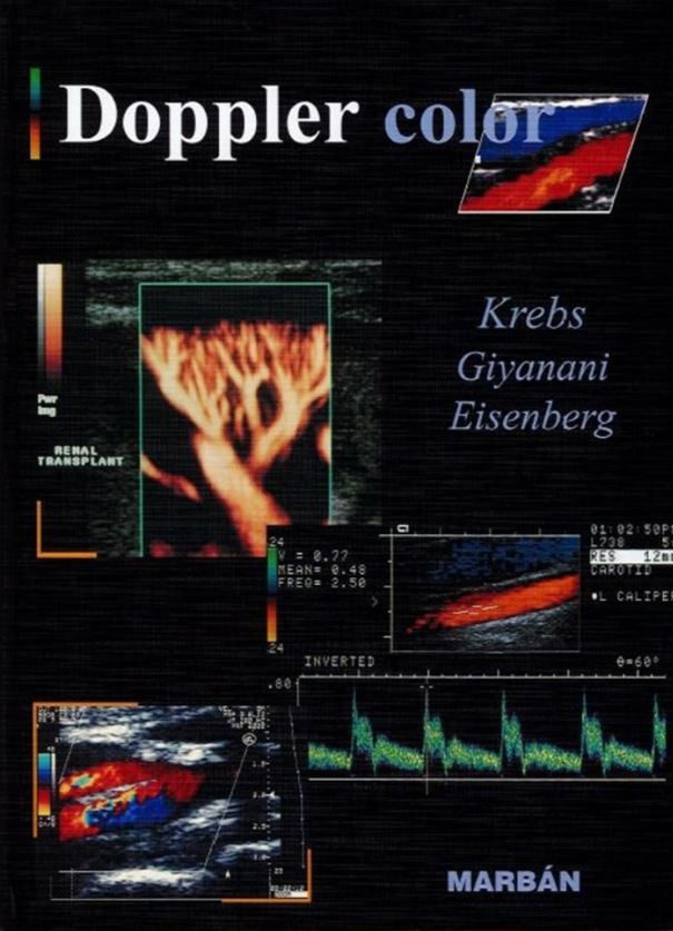 Doppler Color