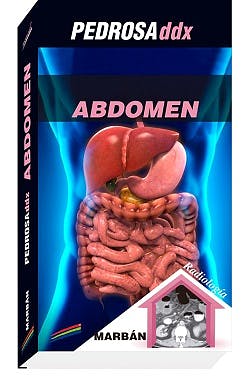 Pedrosa Ddx: Abdomen