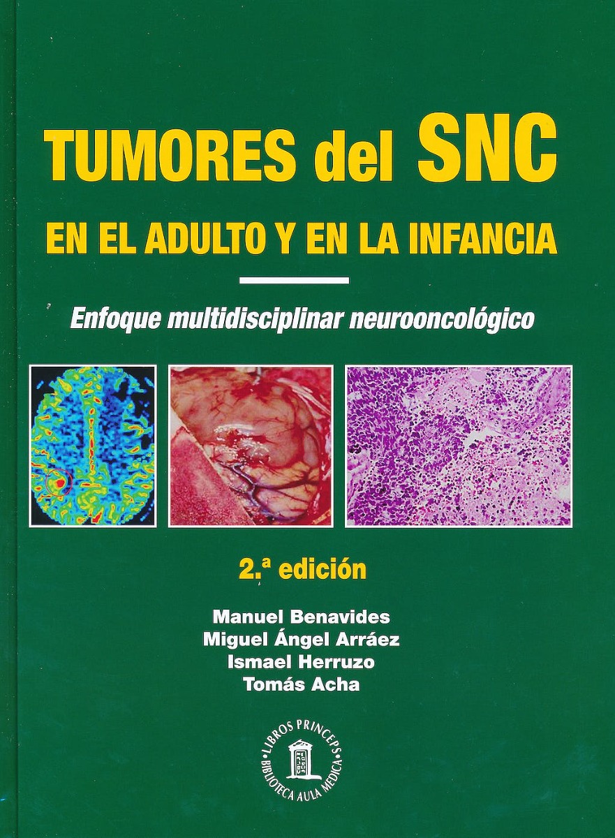 Tumores Del Sistema Nervioso Central En El Adulto Y En La Infancia. Enfoque Multidisciplinar Neuro Oncológico