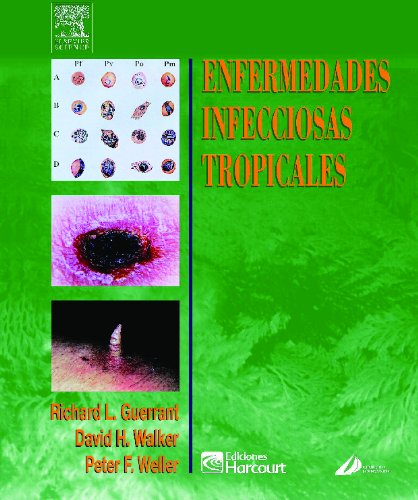 Enfermedades infecciosas tropicales