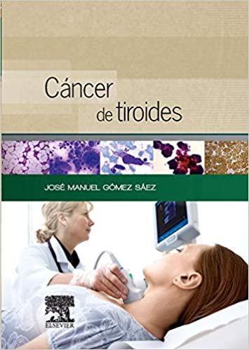 Cáncer De Tiroides
