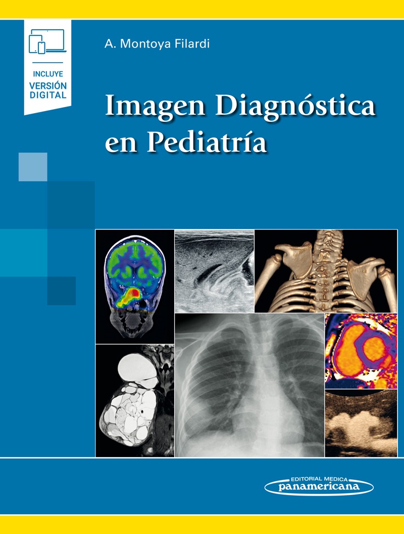 Imagen Diagnóstica En Pediatría (Incluye Versión Digital)