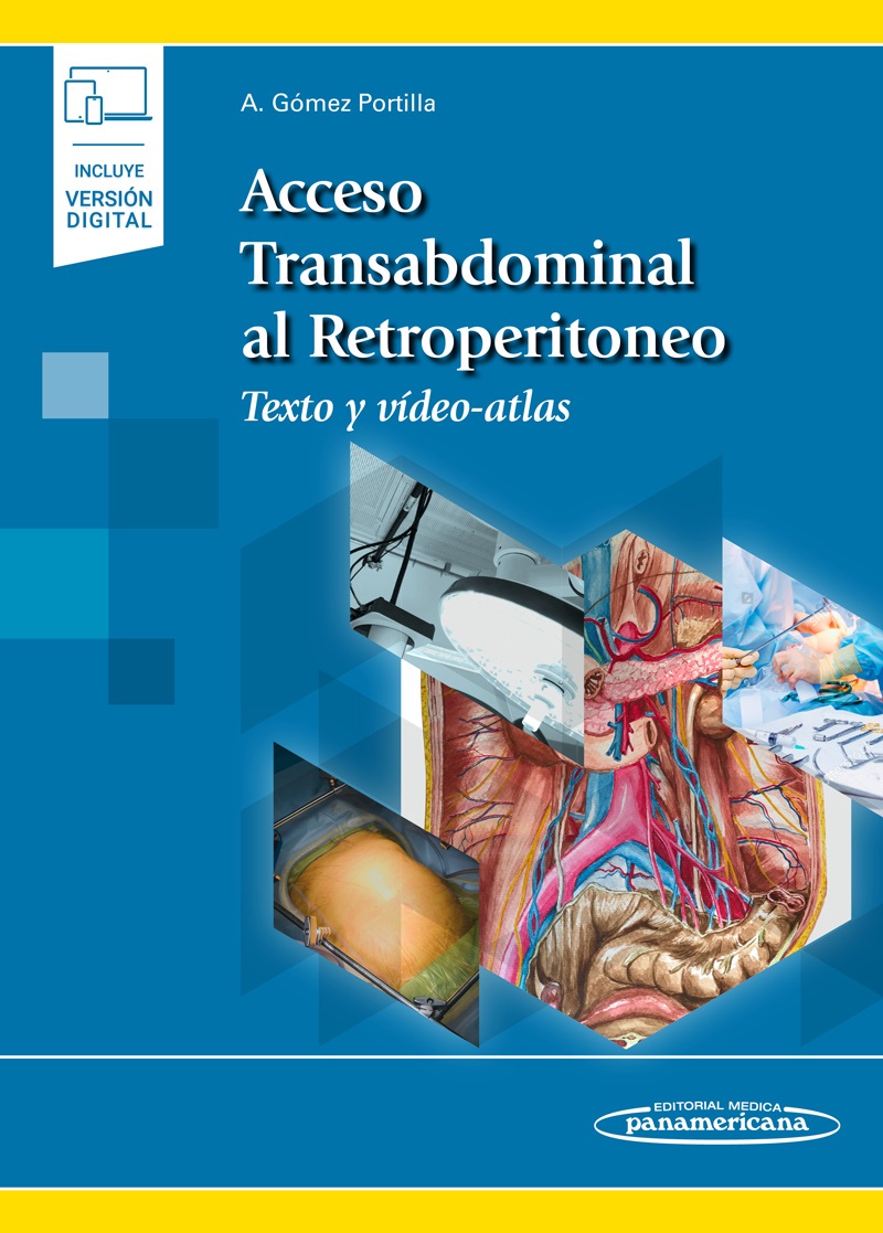 Acceso Transabdominal Al Retroperitoneo