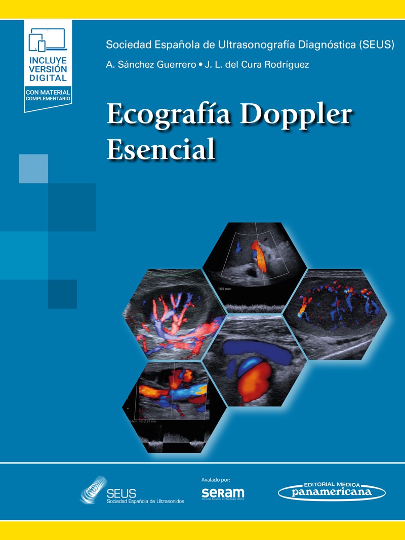 Ecografía Doppler Esencial