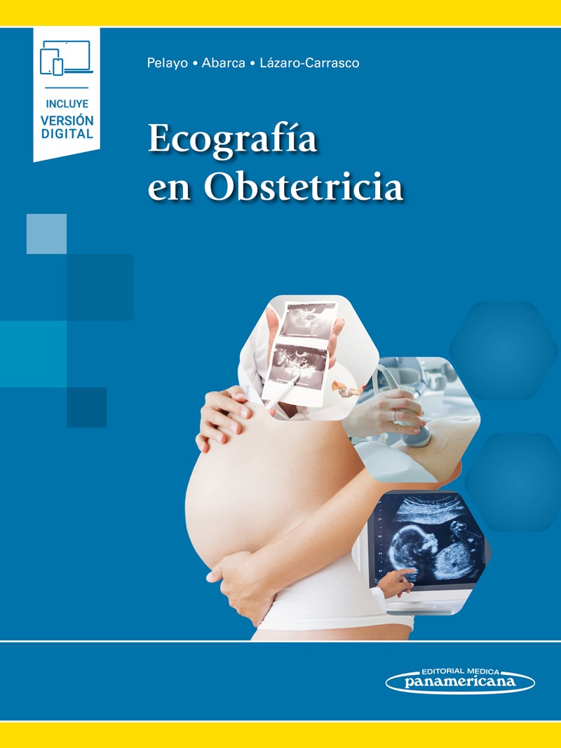 Ecografía En Obstetricia