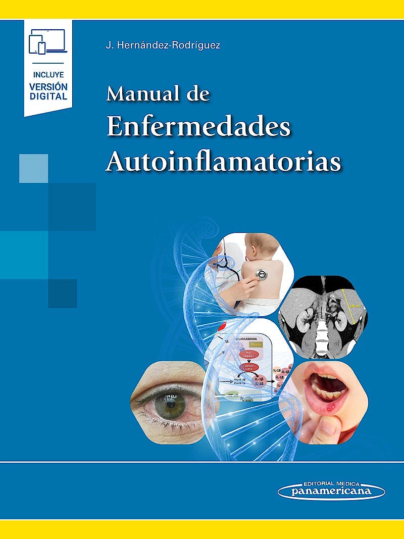 Manual De Enfermedades Autoinflamatorias