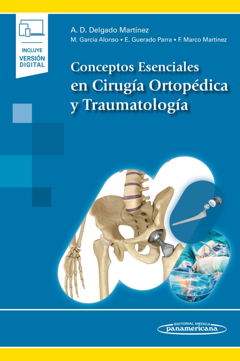 Conceptos Esenciales En Cirugía Ortopédica Y Traumatología