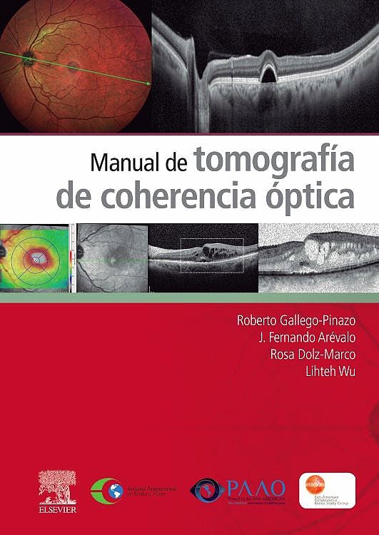Manual De Tomografía De Coherencia Óptica