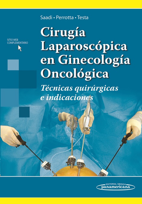 Cirugía Laparoscópica En Ginecología Oncológica