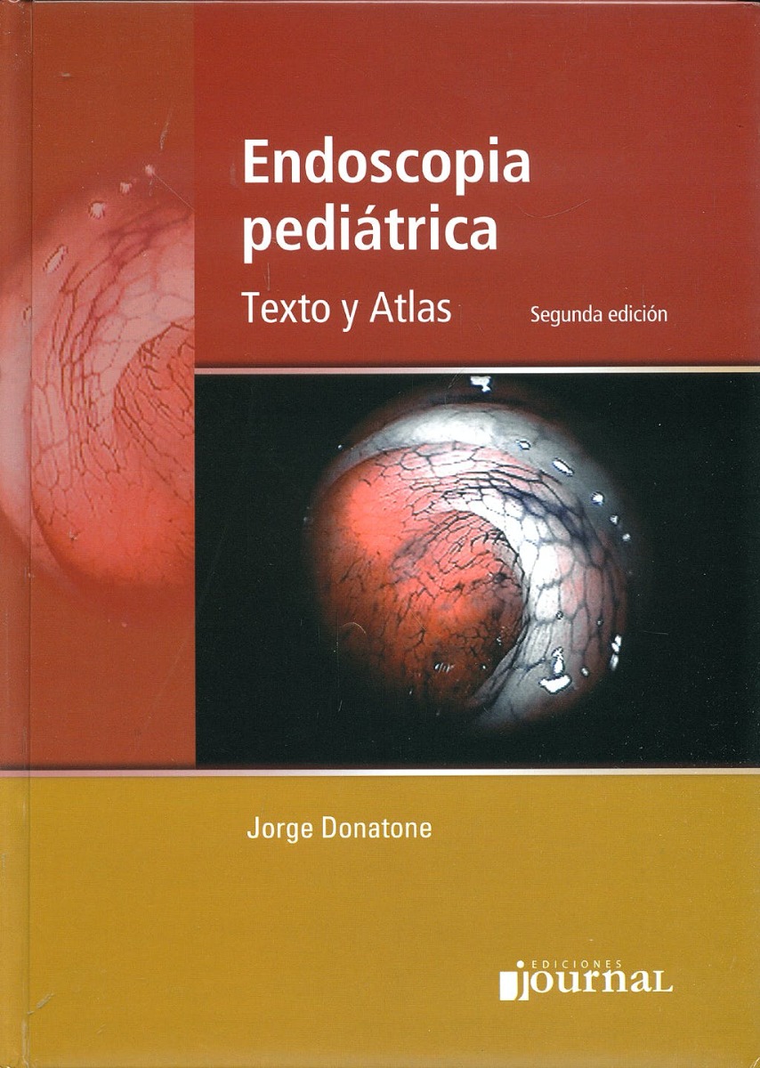 Endoscopia Pediátrica