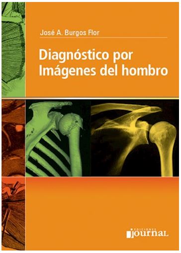 Diagnóstico Por Imágenes Del Hombro