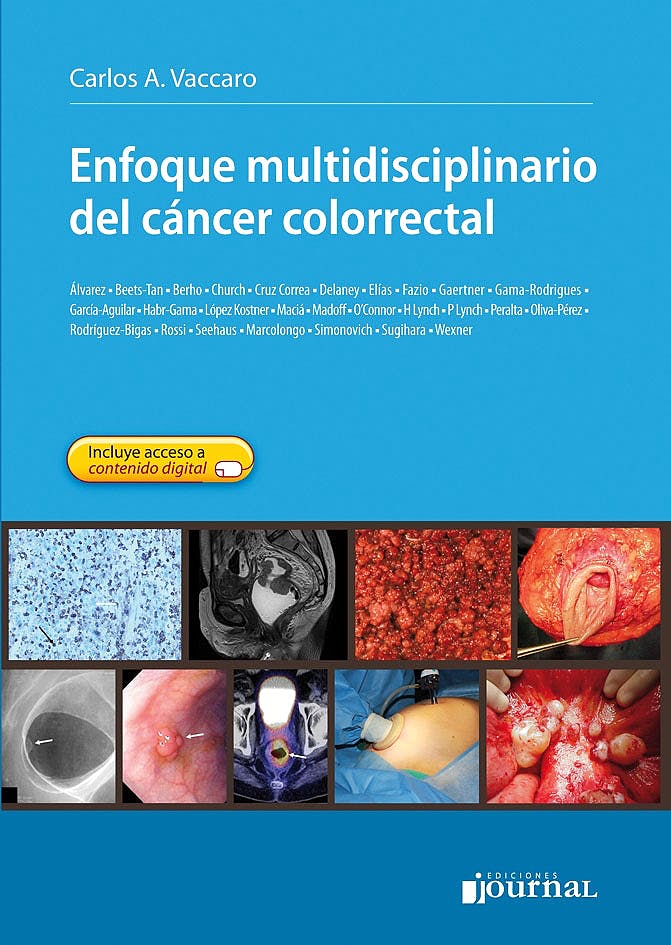 Enfoque Multidisciplinario Del Cáncer Colorrectal