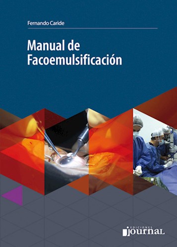 Manual De Facoemulsificación