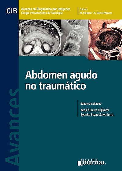 Avances En Diagnóstico Por Imágenes 13: Abdomen Agudo No Traumático