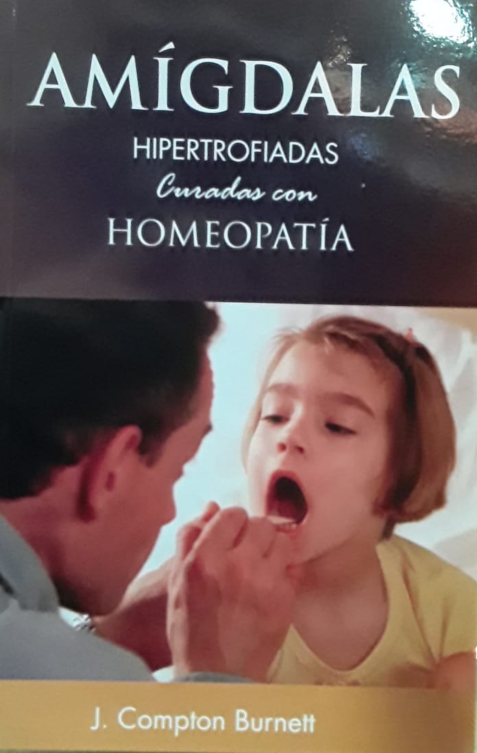 Amígdalas Hipertro Fiadas Curadas Con Homeopatía