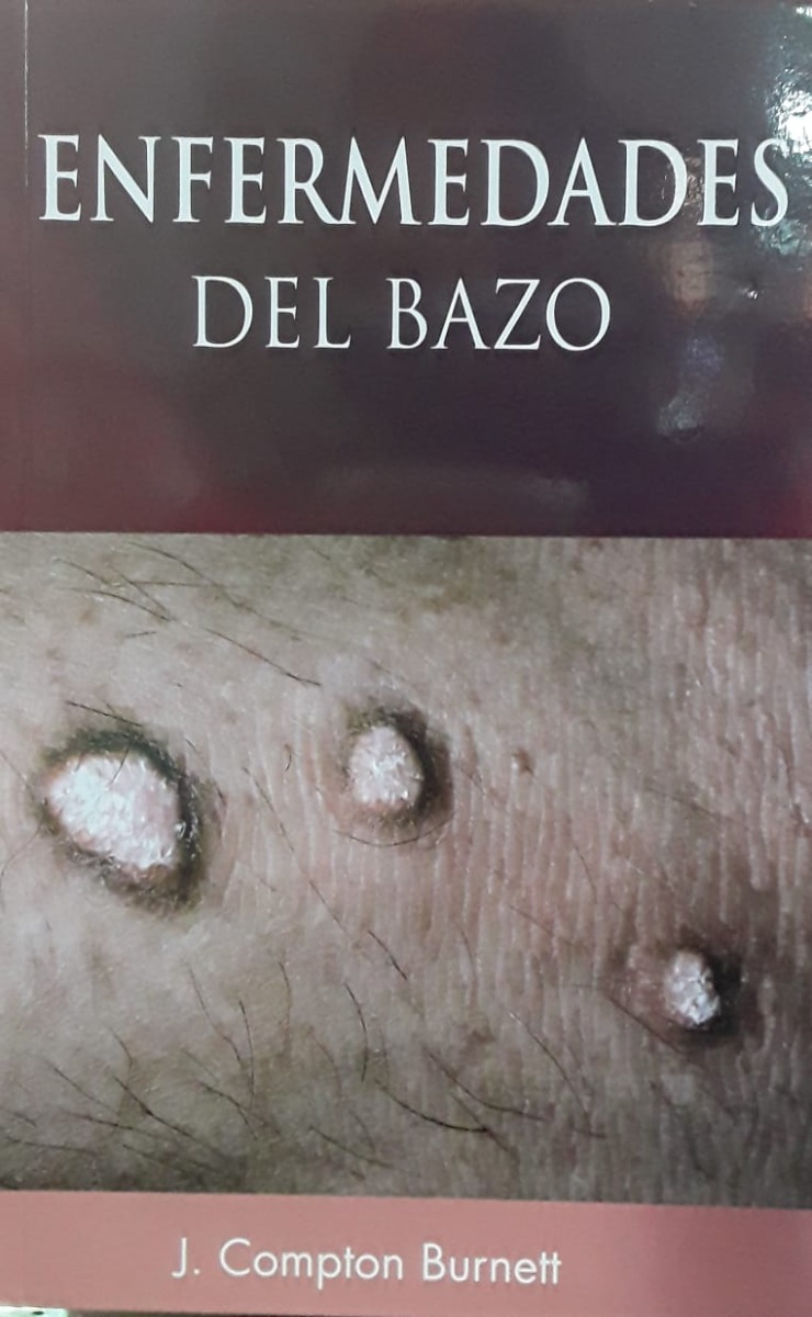 Enfermedades Del Bazo