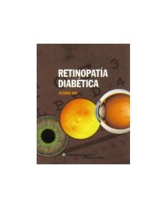 Retinopatía Diabética