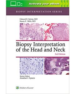 Biopsy Interpretation Of The Head And Neck 3Ed