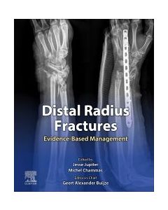 Distal Radius Fractures, 1St Edition