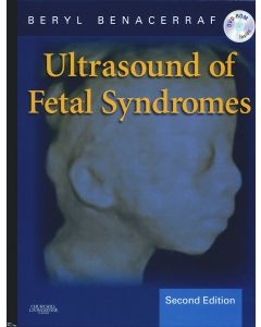 Ultrasound Of Fetal Syndromes