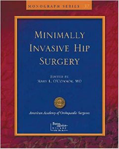 Limited Incisions For Total Hip Arthroplasty (Monograph Series)