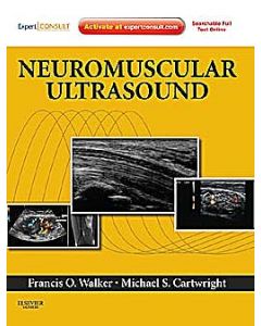 Neuromuscular Ultrasound
