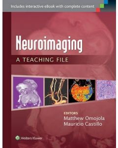 Neuroimaging: A Teaching File