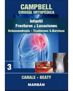 Campbell Cirugía Ortopédica, Tomo 3: Infantil. Fracturas Y Luxaciones: Osteocondrosis. Trastornos Sistema Nervioso