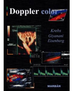 Doppler Color