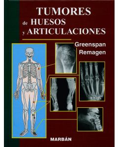 Tumores de Huesos y Articulaciones