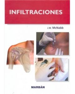 Infiltraciones