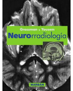 Neurorradiología 