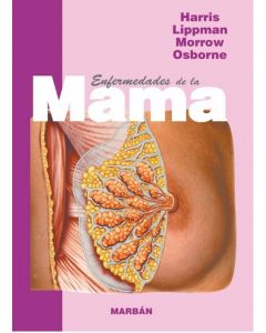 "La Mama Tapa Rustica 21"""