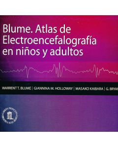 Blume. Atlas De Electroencefalografia En Niños Y Adultos