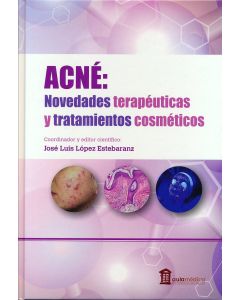 Acné. Novedades Terapéuticas Y Tratamientos Cosméticos.